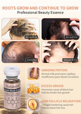 안티 헤어 러스 세럼 세트 바늘 없이 메소 테라피 폼 룰라 폼 리 재 성장 10ml / 병 개인 레이블