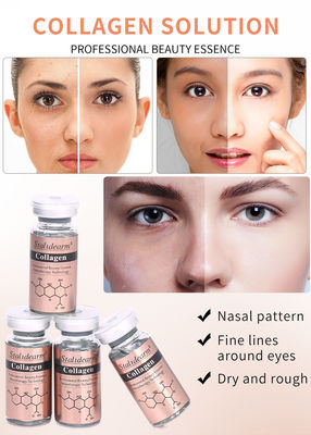 10ml 개인 레이블 스탈리드어름 항 노화 강화 펩타이드 콜라겐 알로에 얼굴 에센스 백화 항 주름 세움