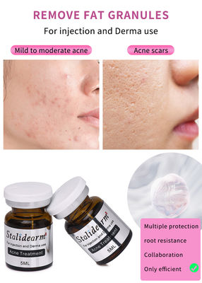 공장 공급품 피부 증폭자 여드름 수리 여드름 치료 흑점 제거 메소 테라피 세럼 주입 OEM/ODM