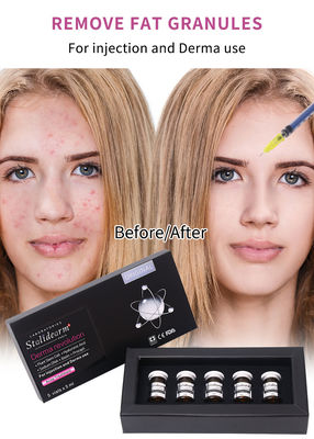 피부 증폭제 5ml 피부 회복 메소 테라피 혈청 주입