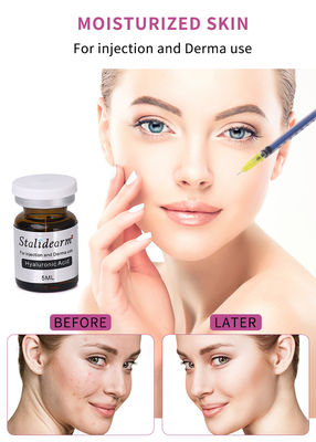 화장품 뷰티 5ml 항 노화 미크로네이들링 히알루론산 주입 필러 주입
