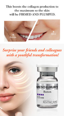 얼굴을 위한 미백 MESO BOTOX 혈청 Microneedling 혈청 Mesotherapy 혈청