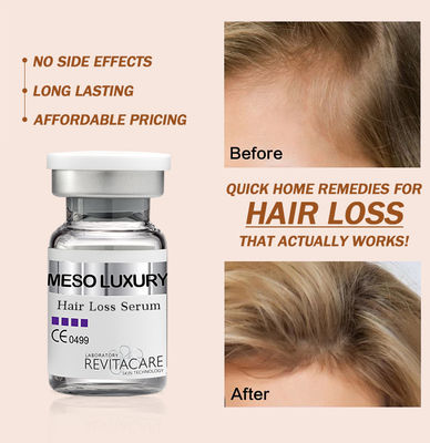 Herbal Natural Hair Regrowth Serum Treatment 10ml Custom Private Label