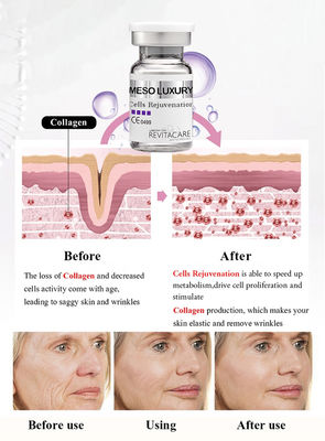 피부 희게하기를 위한 Meso 세포 젊어지게 하는 힘 혈청 노화 방지 Microneedling