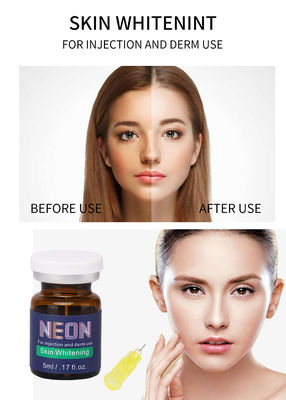 젊은 피부를 위한 5ml 피부 희게하는 혈청 Mesotherapy 주입 얼굴 혈청