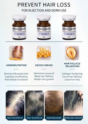 모발 성장을 위한 호화스러운 반대로 탈모 혈청 Mesotherapy 주입 처리